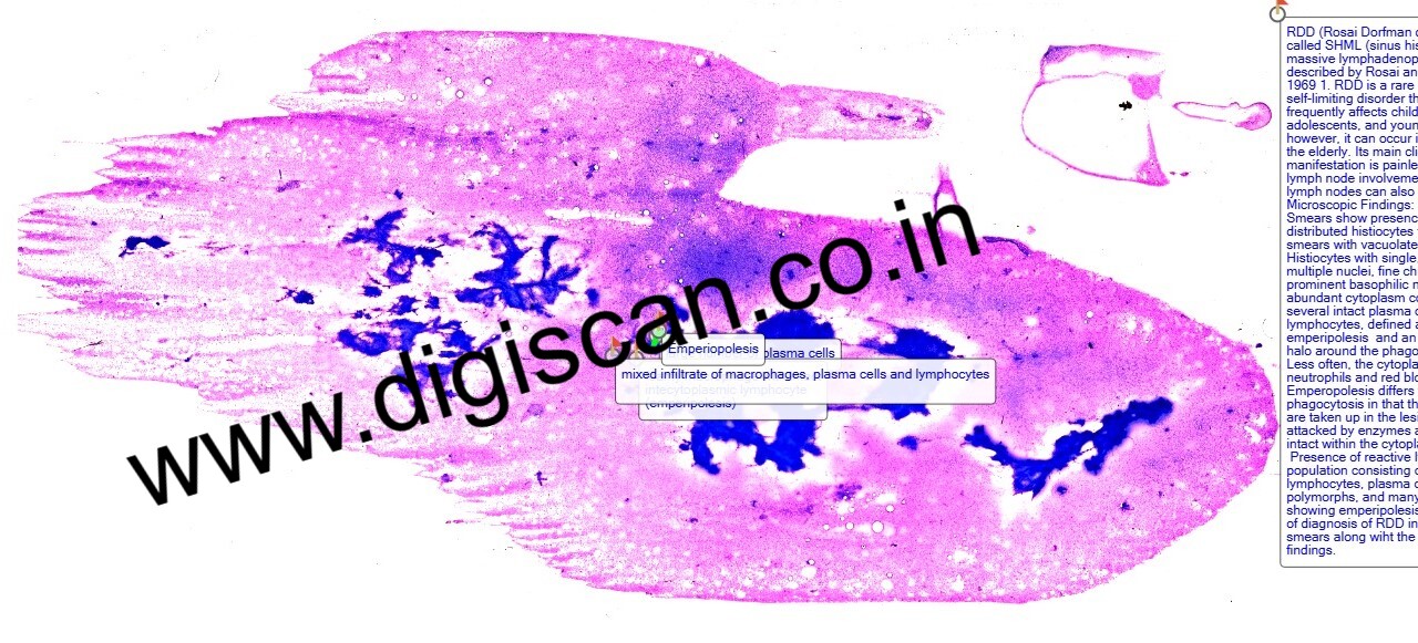 Fine Needle Aspiration Cytology (FNAC) Digital Slides Set